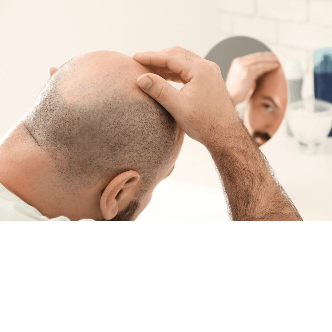 all-about-hair-transplants-it-really-works-vitamins-how-can-i-make-my